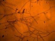 Rhizoctone brun 8.180